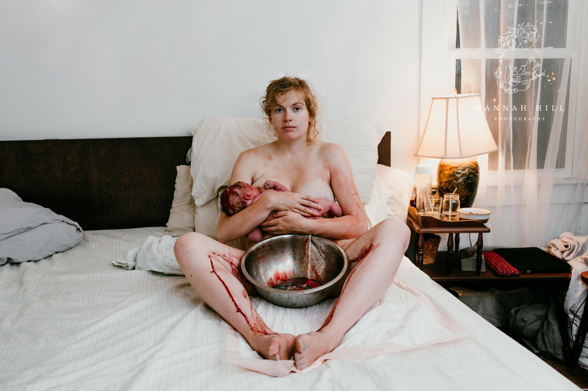 Une mère nue assise dans un lit, placenta dans un bol entre ses jambes ensanglantées, allaite sont nourrisson